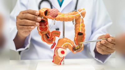 Darmkrebs ist gut behandelbar. (Bild: iStock/Warawan Tongsri)