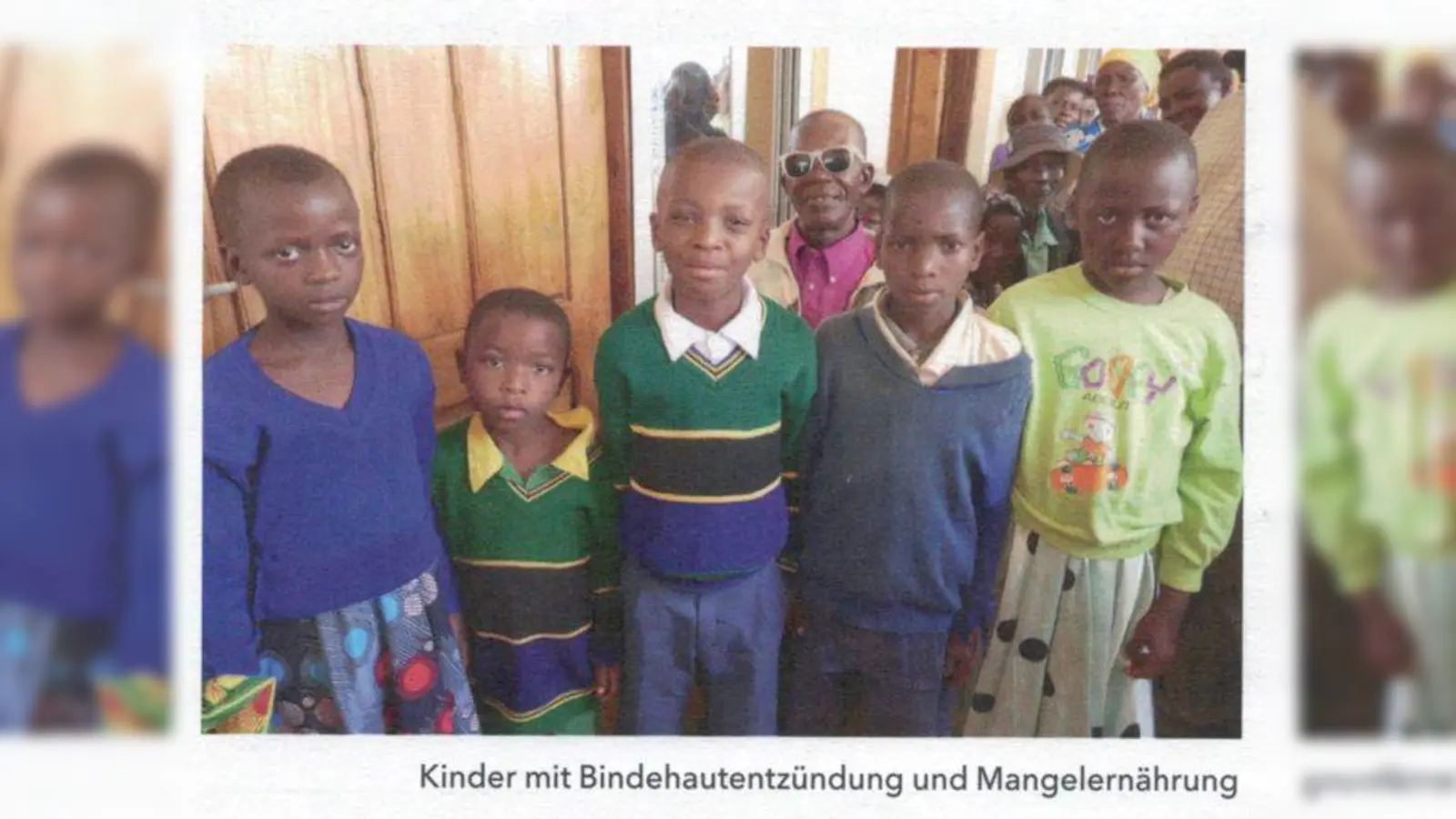 Kinderkrankenhaus Peramiho in Tansania mit Mangelernährung und Bindehautentzündung. (Bild: Sibylle Scharnagl)
